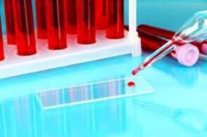 Hemoscopy of blood drops for parasites