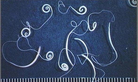 Worms from the human body