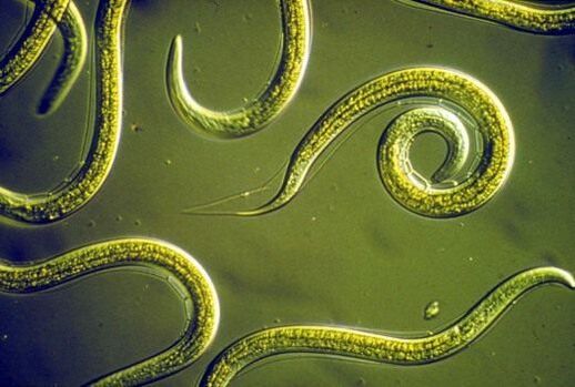 Parasitic nematode worms that live in the small intestine of humans