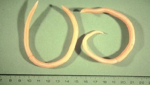 Roundworms are worms that manifest as fatigue and coughing.