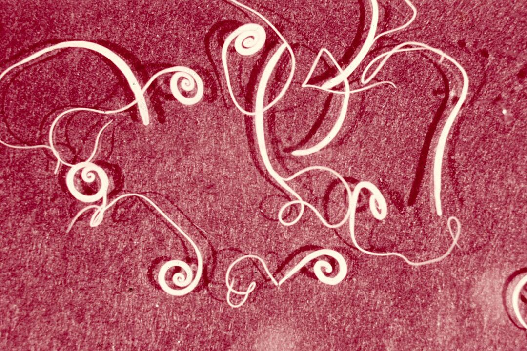 Human Trichinella worms