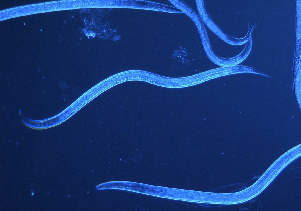 human worm